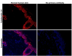 Invitrogen Cytokeratin 14 Monoclonal Antibody (LL002) 500 &mu;L; Unconjugated:Antibodies,