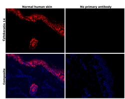 Invitrogen Cytokeratin 14 Monoclonal Antibody (LL002) 500 &mu;L; Unconjugated:Antibodies,