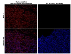 Invitrogen Bcl-2 Monoclonal Antibody (100/D5) 500 &mu;L; Unconjugated:Antibodies,