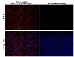Invitrogen Bcl-2 Monoclonal Antibody (100/D5) 500 &mu;L; Unconjugated:Antibodies,