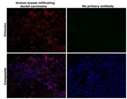 Invitrogen™ Vimentin Monoclonal Antibody (V9), Alexa Fluor™ 555