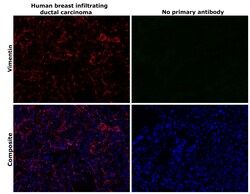 Invitrogen Vimentin Monoclonal Antibody (V9), Alexa Fluor 555 50 &mu;L;
