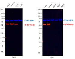 Invitrogen Vimentin Monoclonal Antibody (V9), Alexa Fluor 555 50 &mu;L;