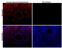 Invitrogen Vimentin Monoclonal Antibody (V9) 500 &mu;L; Unconjugated:Antibodies,