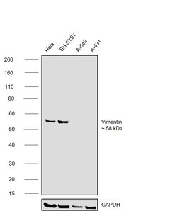 Invitrogen Vimentin Monoclonal Antibody (V9) 500 &mu;L; Unconjugated:Antibodies,