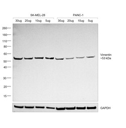 Invitrogen Vimentin Monoclonal Antibody (V9) 500 &mu;L; Unconjugated:Antibodies,