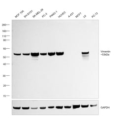 Invitrogen Vimentin Monoclonal Antibody (V9) 500 &mu;L; Unconjugated:Antibodies,