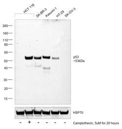 Invitrogen p53 Monoclonal Antibody (DO-7) 500 &mu;L; Unconjugated:Antibodies,