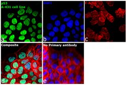 p53 Monoclonal Antibody (DO-1):Antibodies, Monoclonal