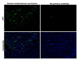 p53 Monoclonal Antibody (DO-1):Antibodies, Monoclonal