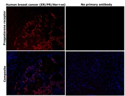 Invitrogen Progesterone Receptor Monoclonal Antibody (PgR636) 500 &mu;L | Buy Online | Invitrogen&trade; | Fisher Scientific