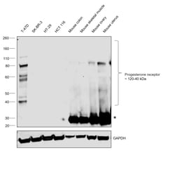 Invitrogen Progesterone Receptor Monoclonal Antibody (PgR636) 500 &mu;L | Buy Online | Invitrogen&trade; | Fisher Scientific