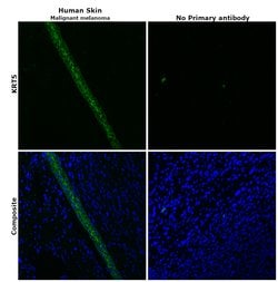 Invitrogen Cytokeratin 5 Monoclonal Antibody (XM26) 500 &mu;L; Unconjugated:Antibodies,