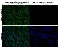 Invitrogen Chromogranin A Monoclonal Antibody (LK2H10) 500 &mu;L; Unconjugated:Antikörper