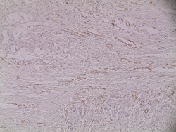 Invitrogen CD31 Monoclonal Antibody (JC/70A) 500 &mu;L | Buy Online | Invitrogen&trade; | Fisher Scientific