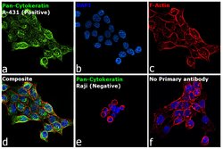 Invitrogen Cytokeratin Pan Antibody Cocktail 500 &mu;L; Unconjugated:Antibodies,