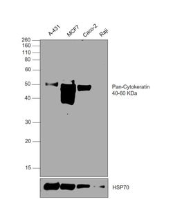 Invitrogen Cytokeratin Pan Antibody Cocktail 500 &mu;L; Unconjugated:Antibodies,