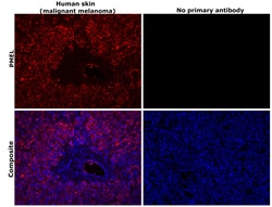 Invitrogen PMEL Monoclonal Antibody (HMB45) 500 &mu;L; Unconjugated:Anticuerpos