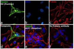 Invitrogen Desmin Monoclonal Antibody (D33) 500 &mu;L; Unconjugated:Antibodies,