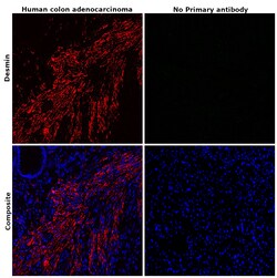 Invitrogen Desmin Monoclonal Antibody (D33) 500 &mu;L; Unconjugated:Antibodies,