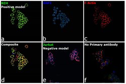 Invitrogen INSR Monoclonal Antibody (CT-3) 500 &mu;L; Unconjugated:Antibodies,