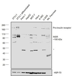 Invitrogen INSR Monoclonal Antibody (CT-3) 500 &mu;L; Unconjugated:Antibodies,