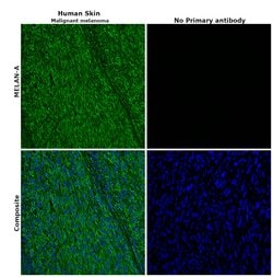 Invitrogen Melan-A Monoclonal Antibody (A103) 500 &mu;L; Unconjugated:Antibodies,