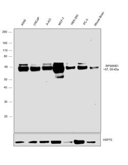 Invitrogen p70 S6 Kinase Monoclonal Antibody (T.527.6) 100 &mu;L; Unconjugated:Antibodies,