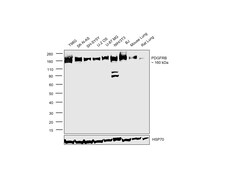 Invitrogen PDGFRB Monoclonal Antibody (G.290.3) 100 &mu;L; Unconjugated:Antibodies,