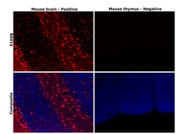 Invitrogen S100B Monoclonal Antibody (9A11B9) 100 &mu;L; Unconjugated:Antibodies,