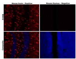 Invitrogen S100B Monoclonal Antibody (9A11B9) 100 &mu;L; Unconjugated:Antibodies,