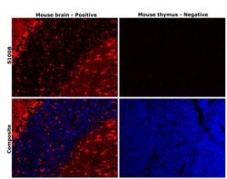 Invitrogen S100B Monoclonal Antibody (9A11B9) 100 &mu;L; Unconjugated:Antibodies,
