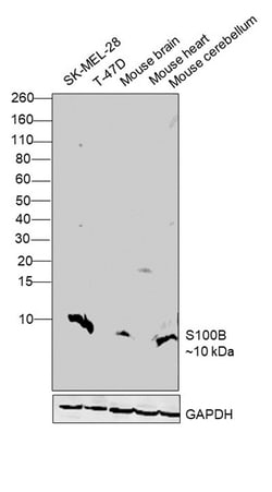 Invitrogen S100B Monoclonal Antibody (9A11B9) 100 &mu;L; Unconjugated:Antibodies,