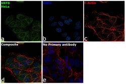 Invitrogen Cytokeratin 8 Monoclonal Antibody (8A5D12) 100 &mu;L; Unconjugated:Antibodies,