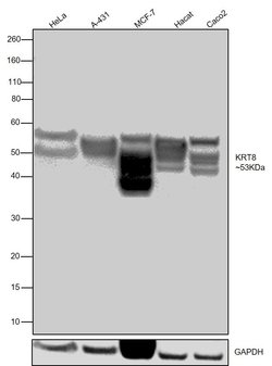 Invitrogen Cytokeratin 8 Monoclonal Antibody (8A5D12) 100 &mu;L; Unconjugated:Antibodies,