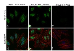 Invitrogen Ki-67 Monoclonal Antibody (8D5) 100 &mu;L; Unconjugated:Antibodies,
