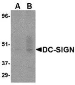 Invitrogen DC-SIGN Monoclonal Antibody (5D7) 100 &mu;g; Unconjugated:Antibodies,