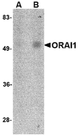 Invitrogen ORAI1 Monoclonal Antibody (6D11A11) 100 &mu;g | Buy Online | Invitrogen&trade; | Fisher Scientific