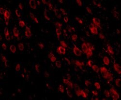 Invitrogen PD-1 Monoclonal Antibody (7A11B1) 100 &mu;g | Buy Online | Invitrogen&trade; | Fisher Scientific