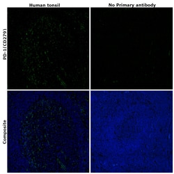 Invitrogen PD-1 Monoclonal Antibody (12A7D7) 100 &mu;g; Unconjugated:Anticuerpos