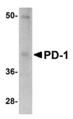 Invitrogen PD-1 Monoclonal Antibody (12A7D7) 100 &mu;g; Unconjugated:Anticuerpos