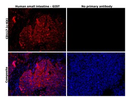 Invitrogen c-Kit Monoclonal Antibody (1C5) 100 &mu;L; Unconjugated:Antistoffer