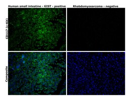 Invitrogen c-Kit Monoclonal Antibody (1C5) 100 &mu;L; Unconjugated:Antistoffer