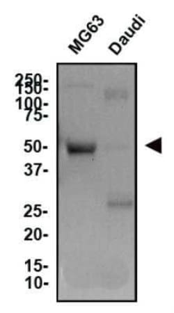 Invitrogen TNFRSF11B Monoclonal Antibody (98A1071) 100 &mu;g; Unconjugated:Antibodies,