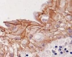 Invitrogen Desmoglein 3 Monoclonal Antibody (5G11) 100 &mu;L; Unconjugated:Antibodies,