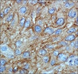 Invitrogen ABCA1 Monoclonal Antibody (HJ1) 100 &mu;L; Unconjugated:Antibodies,