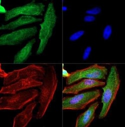 Invitrogen Cytokeratin 1 Monoclonal Antibody (LHK1) 100 &mu;L | Buy Online | Invitrogen&trade; | Fisher Scientific