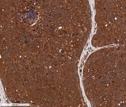 Invitrogen Cytokeratin 1 Monoclonal Antibody (LHK1) 100 &mu;L; Unconjugated:Antibodies,