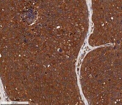Invitrogen Cytokeratin 1 Monoclonal Antibody (LHK1) 100 &mu;L | Buy Online | Invitrogen&trade; | Fisher Scientific