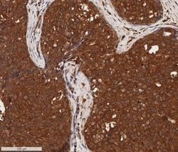Invitrogen Cytokeratin 1 Monoclonal Antibody (LHK1) 100 &mu;L; Unconjugated:Antibodies,